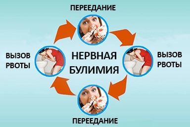 Лечение булимии в Заволжске